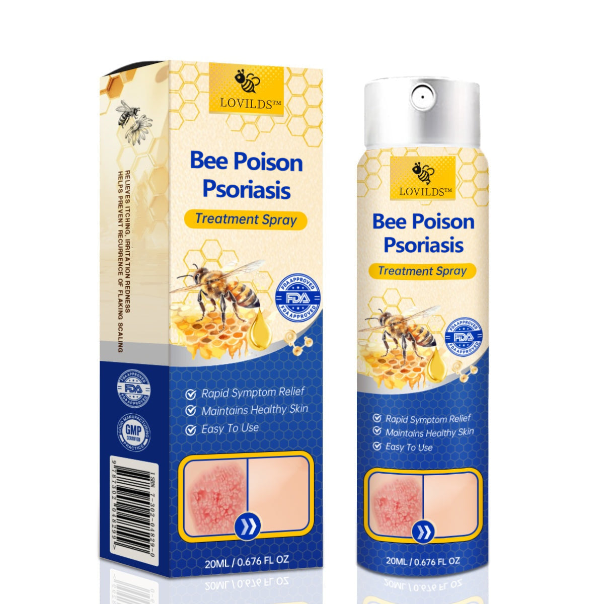 ✨【 official Brand Store】 Last Day Discount: 83% OFF 🌸 LOVILDS™ PsoriaHeal psoriasis Spray pro