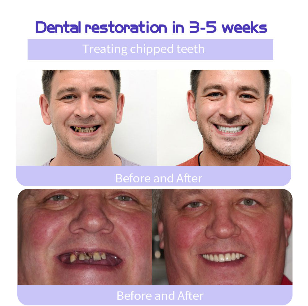HZA (ADA recommended)Teeth Restoration Mineral Powder💎(𝐋𝐢𝐦𝐢𝐭𝐞𝐝 𝐭𝐢𝐦𝐞 𝐝𝐢𝐬𝐜𝐨𝐮𝐧𝐭 𝐋𝐚𝐬𝐭 𝟑𝟎 𝐦𝐢𝐧𝐮𝐭𝐞𝐬⏰)