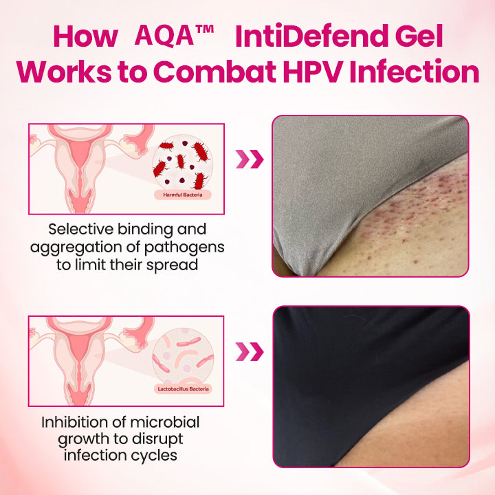 AQA™ IntiDefend Anti-HPV Interferon Gel