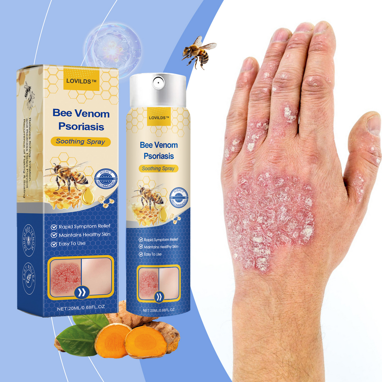 ✨【 official Brand Store】 Last Day Discount: 83% OFF 🌸 LOVILDS™ PsoriaHeal psoriasis Spray pro