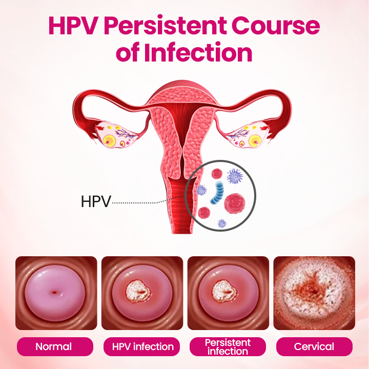 AQA™ IntiDefend Anti-HPV Interferon Gel