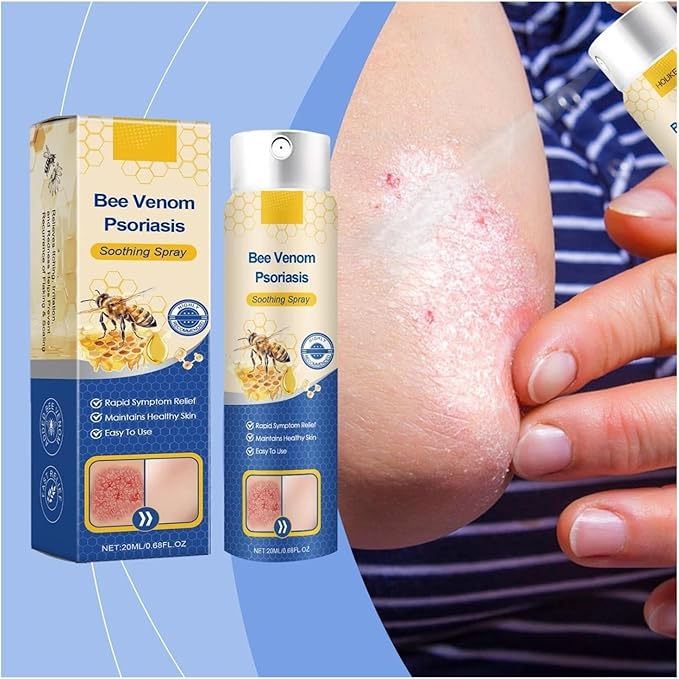 ✨【 official Brand Store】 Last Day Discount: 83% OFF 🌸 LOVILDS™ PsoriaHeal psoriasis Spray pro