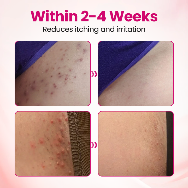 AQA™ IntiDefend Anti-HPV Interferon Gel