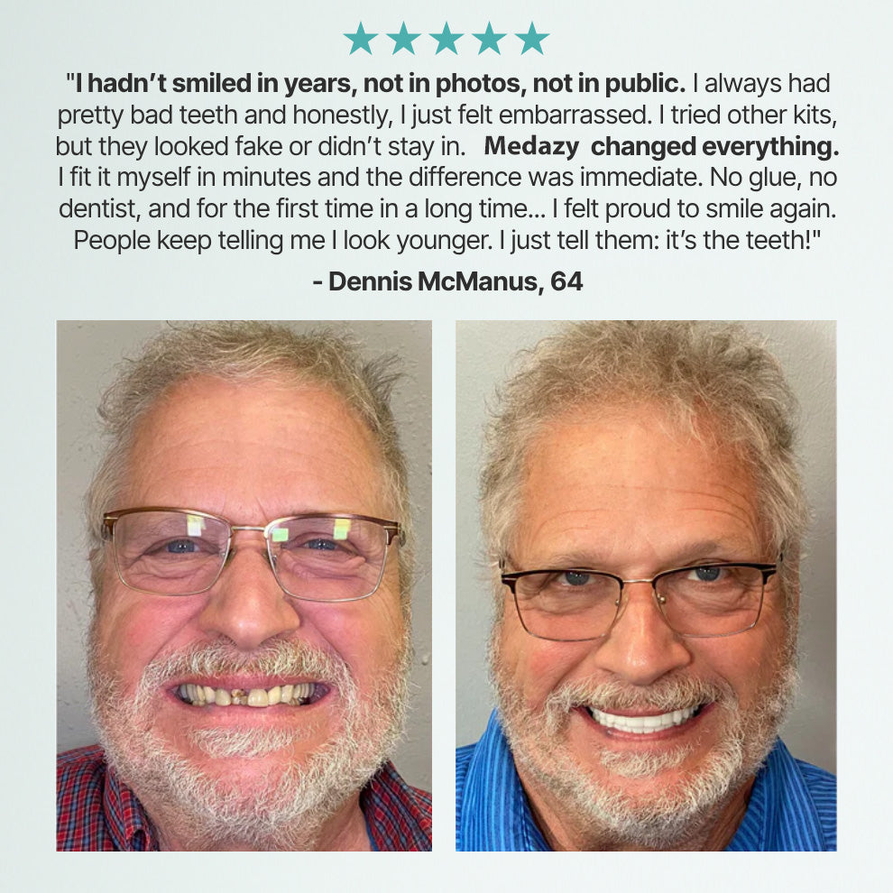 (OFFICIAL STORE) Medazy ? Custom-Fit Full Functional Dentures?