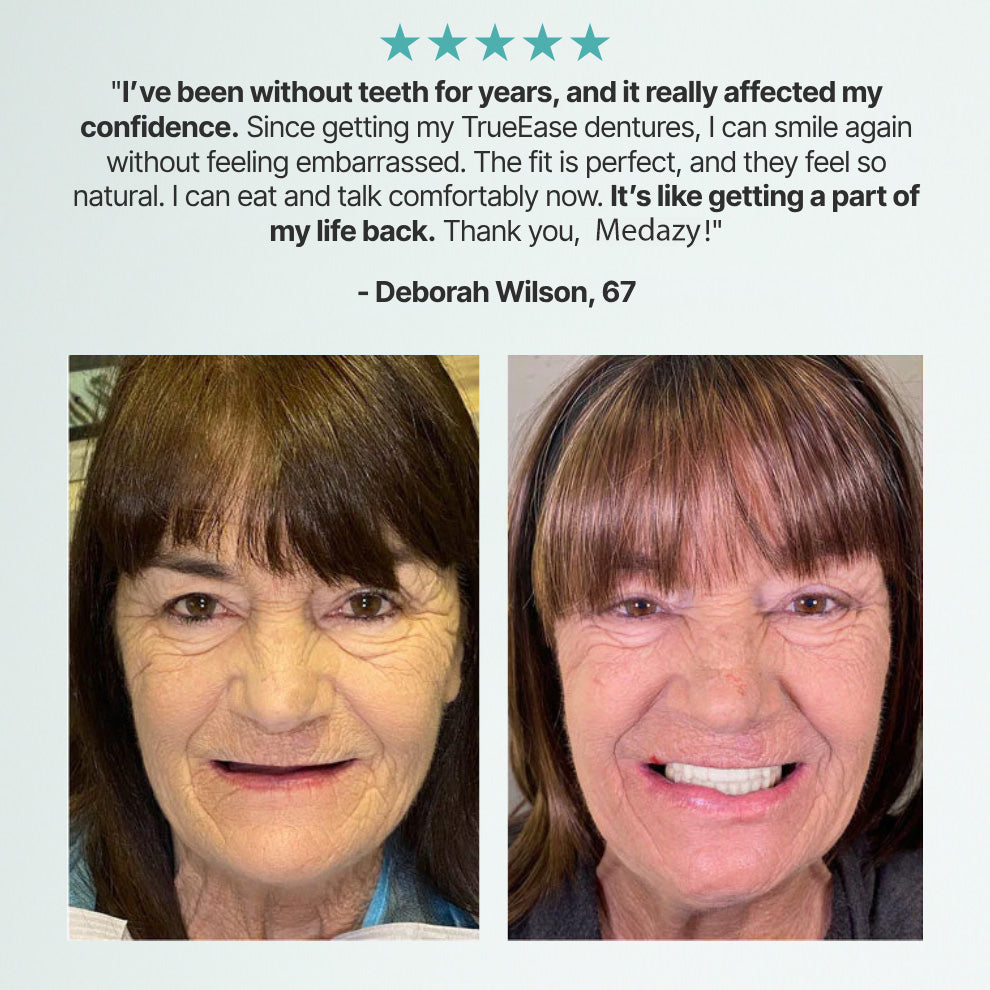 (OFFICIAL STORE) Medazy ? Custom-Fit Full Functional Dentures?