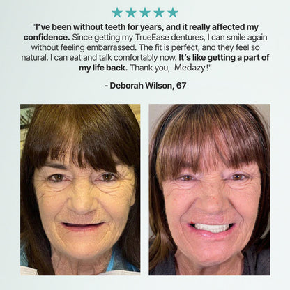 （OFFICIAL STORE） Medazy ? Custom-Fit Full Functional Dentures?